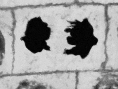 Рис. 2 (7). Митоз в меристематических клетках корешка лука (микрофотография). Ранняя телофаза.
