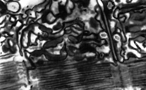 Рис. 2. Электронная микрофотография саркоплазматической сети и Т-системы мышечного волокна.