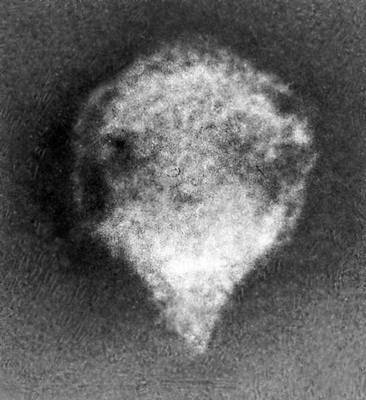 Различные типы вирионов под электронным микроскопом. Бактериофаг с коротким отростком. Увеличено в 600 000 раз.