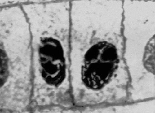 Рис. 2 (1). Митоз в меристематических клетках корешка лука (микрофотография). Интерфаза.