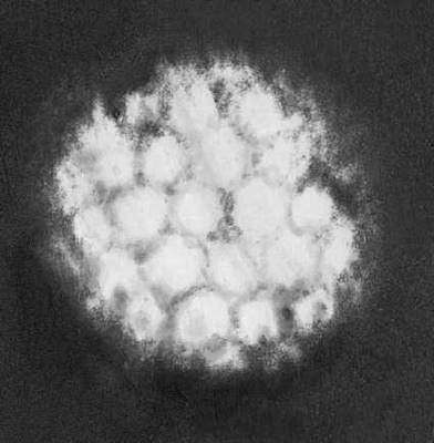 Различные типы вирионов под электронным микроскопом. Вирус герпеса.