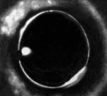 Инфракрасная фотография электронно-дырочной капли в Ge: 1 — образец германия; 2 — электронно-дырочная капля.