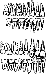 Зубные ряды гоминид: вверху — человека; внизу — синантропа.