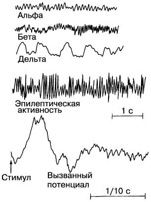ЭЛЕКТРИЧЕСКАЯ АКТИВНОСТЬ мозга регистрируется с помощью электроэнцефалографа. Получаемые кривые - электроэнцефалограммы (ЭЭГ) - могут указывать на расслабленное бодрствование (альфа-волны), активное бодрствование (бета-волны), сон (дельта-волны), эпилепсию или реакцию на определенные стимулы (вызванные потенциалы).