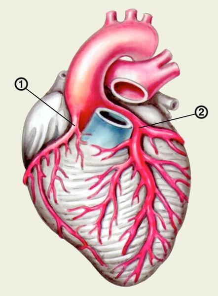 Рис. 7. Сердце с левовенечным типом кровоснабжения: левая венечная артерия (2) и ее ветви более развиты, чем правая венечная артерия (1)