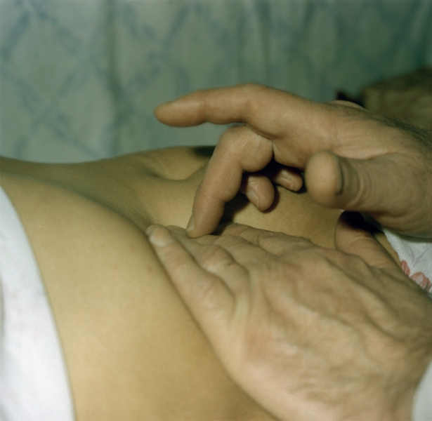 Рис. 3. Положение рук врача при перкуссии пальцем по пальцу по Герхардту