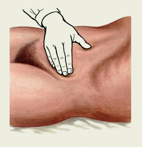 Рис. 5г). Положение рук исследующего при поверхностной ориентировочной пальпации сигмовидной кишки