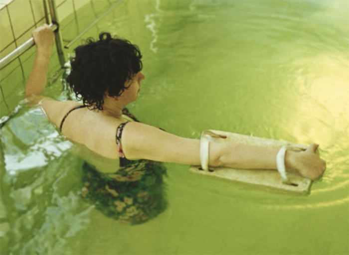 Рис. 6г). Физические упражнения в воде при посттравматической контрактуре в правом плечевом суставе: с поплавком из пенопласта