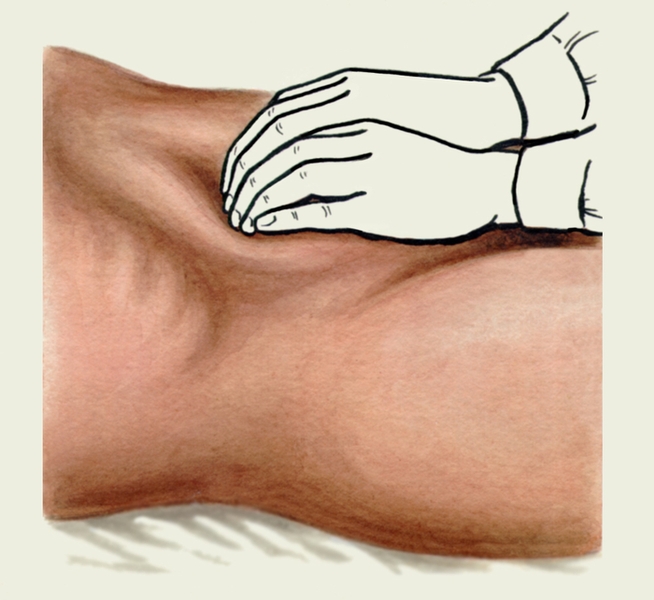 Рис. 5б). Положение рук исследующего при поверхностной ориентировочной пальпации печени