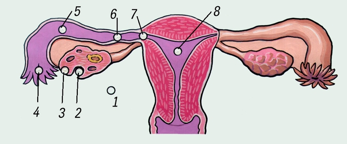 Рис. Схематическое изображение возможных вариантов прикрепления оплодотворенной яйцеклетки: 1—7 — при внематочной беременности (1 — в брюшной полости, 2—3 — в яичнике, 4—7 — в маточной трубе); 8 — в матке (нормальная беременность)