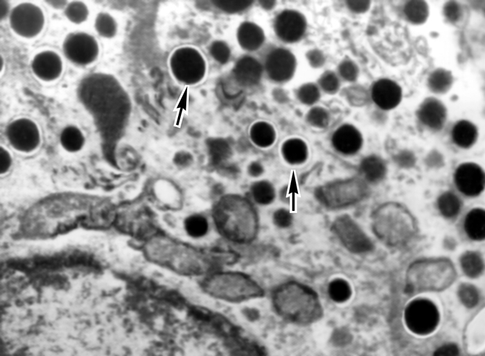 Рис. 4б). Электронограммы разных видов секреторных клеток панкреатических островков:α-клетки (гранулы указаны стрелками); ×15000