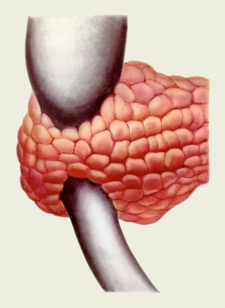 Рис. 7. Схематическое изображение кольцевидной поджелудочной железы