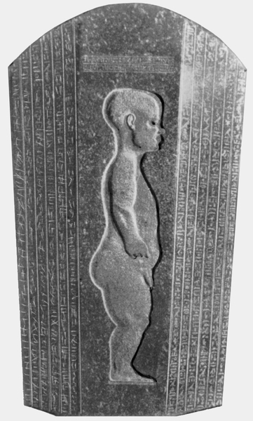 Древнеегипетский барельеф, изображающий больного ахондроплазией