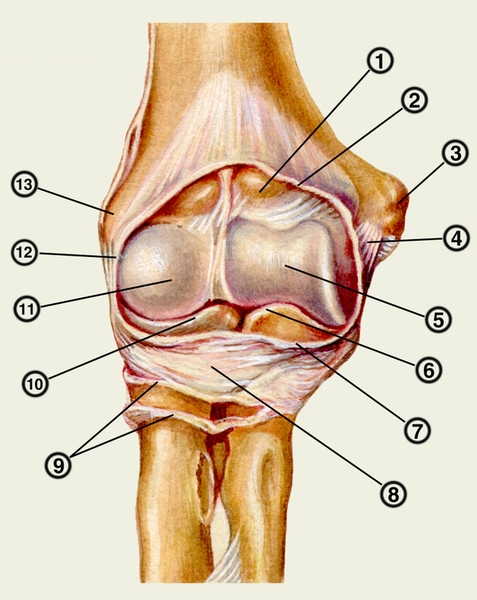 Рис. 2. Топография локтевого сустава. Локтевой сустав с вскрытой суставной капсулой и после удаления окружающих мышц и сухожилий: 1 — венечная ямка; 2 — край вскрытой суставной капсулы; 3 — медиальный надмыщелок; 4 — локтевая коллатеральная связка; 5 — <a href=