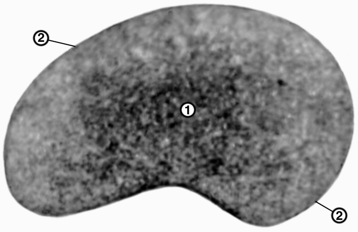 Рис. 1а). Микрофотография эритроцитов: при электронной микроскопии (1 — нежная грануляция, идентифицируемая с гемоглобином; 2 — наружная мембрана эритроцита, имеющая <a href=