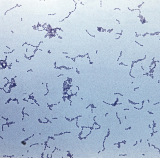 Рис. 5. Чистая культура стрептококка (Streptococcus pyogenes); окраска по Граму: х 800