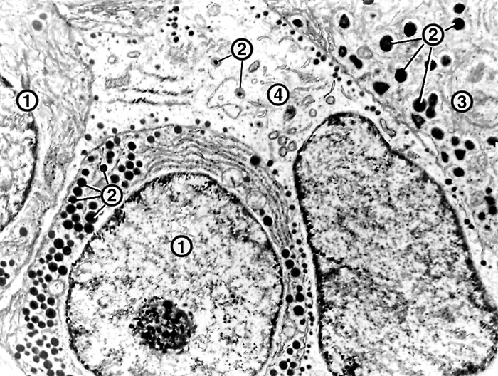 Рис. 3а). Ультраструктура функциональных клеток передней доли гипофиза крысы (в норме): соматотрофы (1) с выраженной эндоплазматической сетью и секреторными гранулами (2); лактотроф (3) с крупными секреторными гранулами (2); кортикотрофы (4) с мелкими секреторными гранулами, ×8000