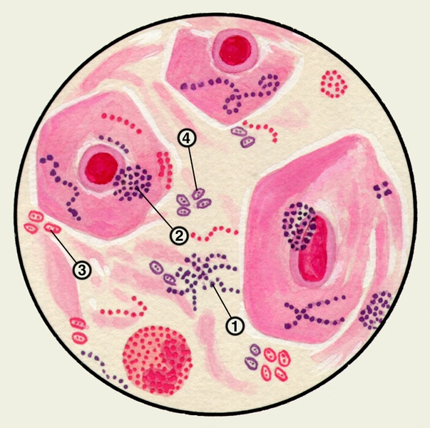 Рис. 6. Стрептококки (1), стафилококки (2), диплобактерии Фридлендера (3), пневмококки (4); <a href=