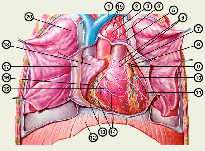 Рис. 4 а). Схематическое изображение сердца (с нервами и сосудами) в грудной полости (вид спереди, полость перикарда вскрыта, эпикард частично удален, легкие оттянуты крючками); 1 — верхняя полая вена; 2 — левый диафрагмальный нерв; 3 — дуга аорты; 4 — левый блуждающий нерв; 5 — легочный ствол; 6 — нервно-узловое поле правого желудочка (в зоне артериального конуса); 7 — левое ушко; 8 — передняя межжелудочковая ветвь левой венечной артерии; 9 — большая вена сердца: 10 — переднее левое нервное сплетение (желудочка); 11 — левый желудочек; 12 — диафрагма; 13 — эпикард; 14 — переднее правое нервное сплетение (желудочка); 15 — правый желудочек; 16 — правая венечная артерия; 17 — перикард (отвернут); 18 — правое ушко; 19 — поверхностная часть сердечного сплетения; 20 — правое легкое