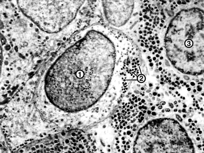 Рис. 3 б). Ультраструктура функциональных клеток передней доли гипофиза крысы (в норме): тиреотроф (1) с небольшим количеством мелких секреторных гранул (2) и соматотроф (3), ×5000
