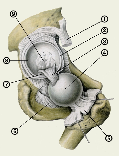 Рис. 2. Правый тазобедренный сустав (суставная капсула рассечена и головка бедренной кости выведена из вертлужной впадины): 1 — прямая <a href=