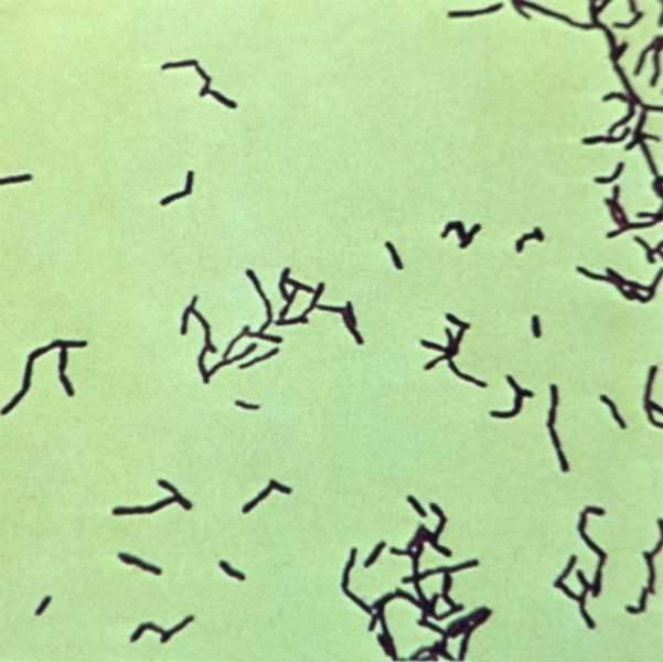 Рис. 9. Чистая культура актиномицета (Actinomyces israelii); окраска по Граму; х 800