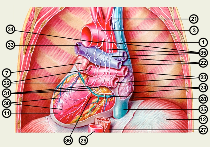 Рис. 4б). Схематическое изображение сердца (с нервами и сосудами) в грудной полости (вид сзади, перикард, эпикард и легкие удалены): 1 — верхняя полая вена; 2 — левый диафрагмальный нерв; 3 — дуга аорты; 4 — левый блуждающий нерв; 5 — легочный ствол; 6 — нервно-узловое поле правого желудочка (в зоне артериального конуса); 7 — левое ушко; 8 — передняя межжелудочковая ветвь левой венечной артерии; 9 — большая вена сердца: 10 — переднее левое нервное сплетение (желудочка); 11 — левый желудочек; 12 — <a href=