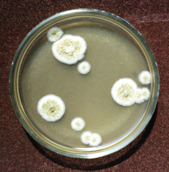 Рис. 3. Колонии грибка Aspergillus flavus на среде Сабуро (пятидневная культура)