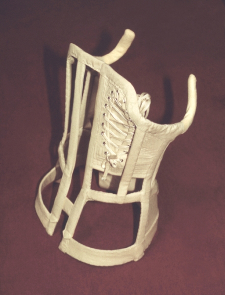 Рис. 9а). Скелетированный корсет ЦИТО с пелотом для коррекции деформации грудной клетки при сколиозе