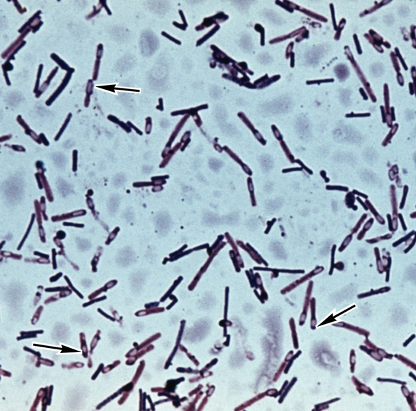 Рис. 6. Чистая культура Clostridium perfrindens; видны субтерминально (указаны стрелками) и центрально расположенные опоры; окраска карболовым фуксином и метиленовым синим; х 800
