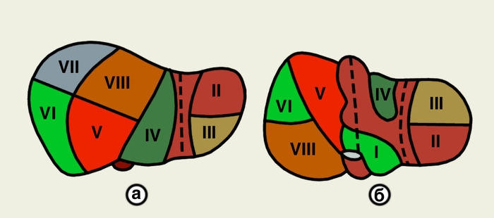 Рис. 3. Схема сегментарного строения печени: а — диафрагмальная поверхность печени; б — висцеральная поверхность печени; римскими цифрами обозначены номера сегментов