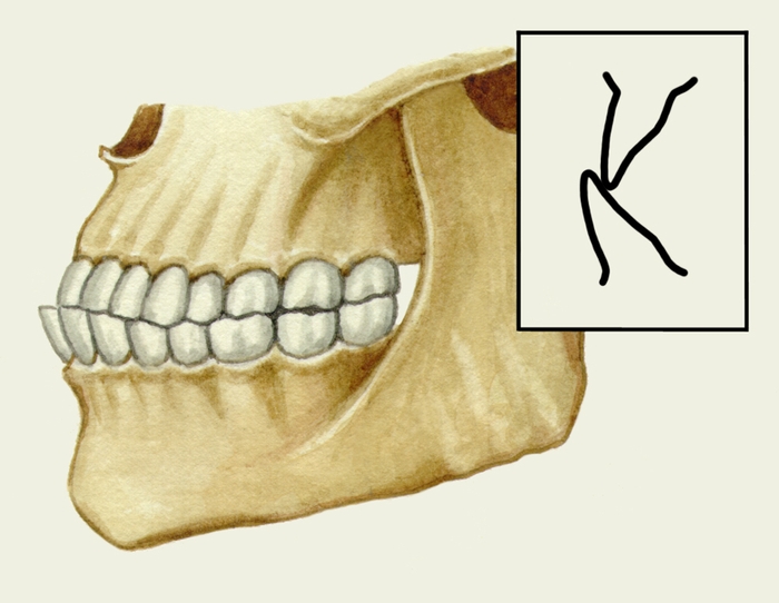 Рис. 1б). Схематическое изображение челюстей при основных разновидностях нормального прикуса (вид сбоку): прогенический прикус