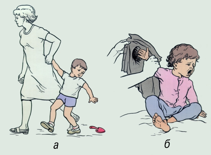 Рис. 2. Механизм возникновения подвывиха головки лучевой кости у ребенка: а — на прогулке; б — при одевании