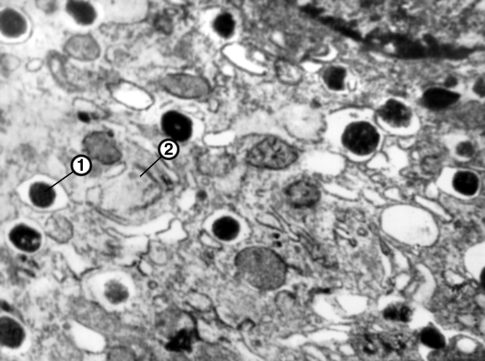 Рис. 4а). Электронограммы разных видов секреторных клеток панкреатических островков: β-клетки (1 — гранулы, 2 — митохондрии); ×15000