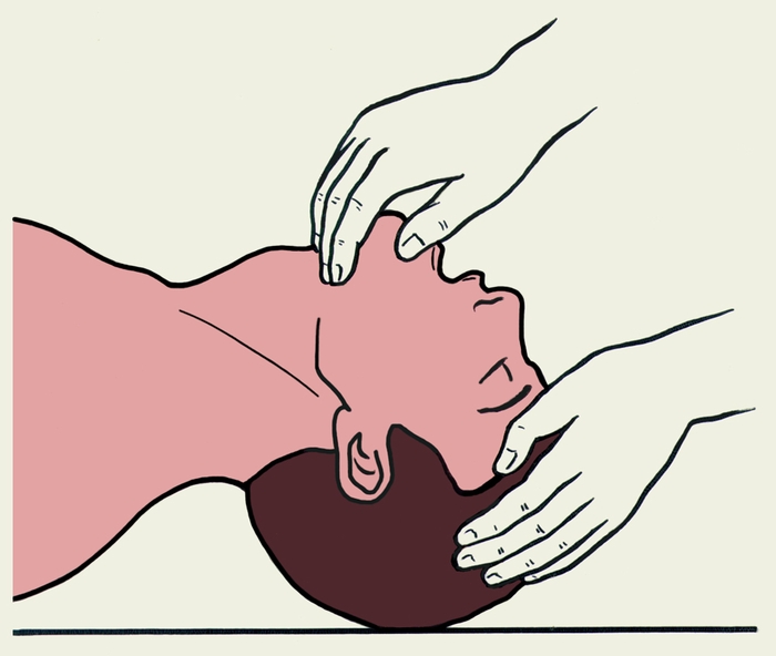 Рис. 1. Положение головы больного при проведении искусственной вентиляции легких по способу изо рта в рот или изо рта в нос