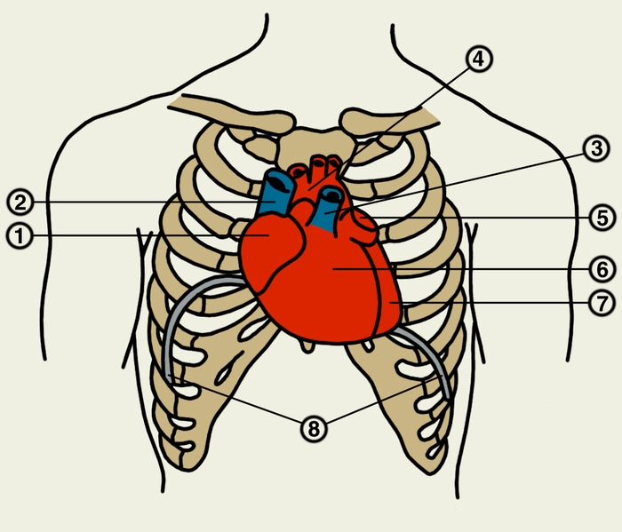 Рис. 3. Схематические изображение проекции отделов сердца, крупных сосудов и куполов диафрагмы на переднюю стенку грудной клетки: 1 — правое предсердие; 2 — верхняя полая вена; 3 — легочный ствол; 4 — дуга аорты; 5 — левое ушко; 6 — правый желудочек; 7 — левый желудочек; 8 — правый и левый куполы диафрагмы
