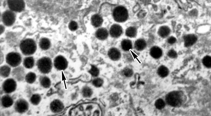 Рис. 4в). Электронограммы разных видов секреторных клеток панкреатических островков: δ-клетки (гранулы указаны стрелками); ×15000