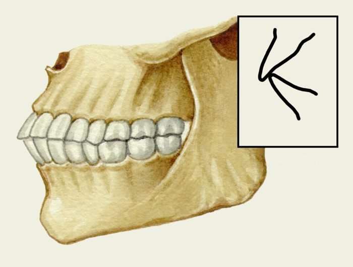 Рис. 1г). Схематическое изображение челюстей при основных разновидностях нормального прикуса (<a href=