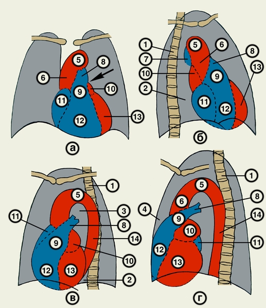 Рис. 22. Схемы рентгеновского изображения сердца и крупных сосудов в прямой (а), правой (первой) косой (б), левой (второй) косой (в) и левой боковой (г) проекциях: 1 — <a href=
