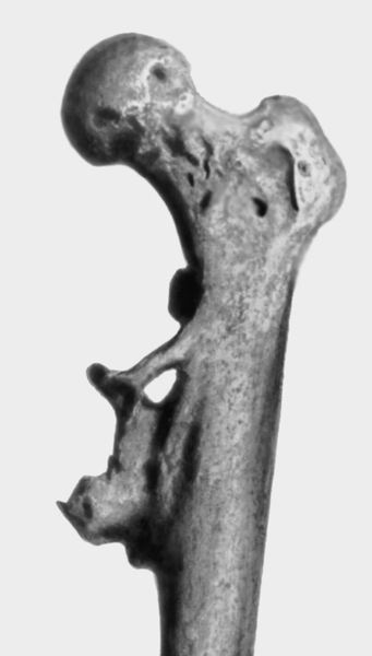 Бедренная кость питекантропа с выраженной патологией костной ткани
