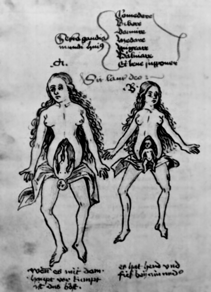 Схематическое изображение головного и ножного предлежаний плода. Из рукописи De secretis mulierum Альберта Великого