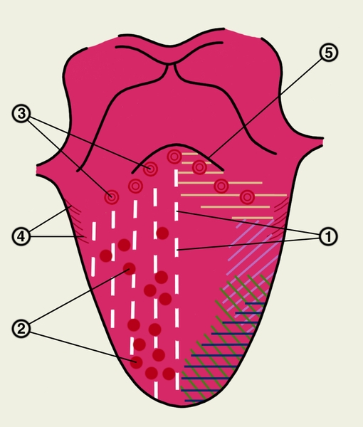 Рис. 1. Схематическое изображение сосочков языка и зон восприятия вкусовых раздражителей на его верхней поверхности: 1 — нитевидные сосочки; 2 — грибовидные сосочки; 3 — желобоватые сосочки; 4 — <a href=