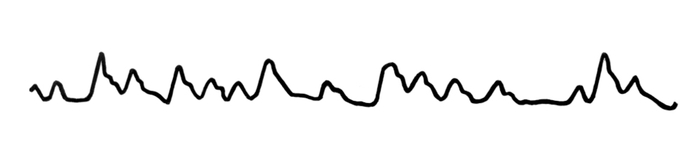 Рис. 3. Артериальная сфигмограмма при мерцательной аритмии: пульсовые волны имеют разную амплитуду и следуют беспорядочно через неравные промежутки времени