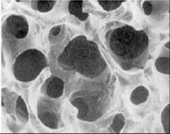 Микропористое покрытие титанового протеза дает возможность костной ткан
