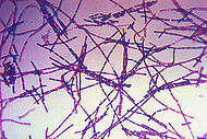 Bacillus anthracis Gram.jpg