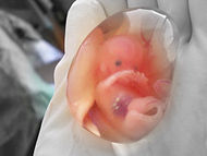 Human fetus 10 weeks - therapeutic abortion.jpg