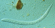 Strongyloides stercoralis larva.jpg
