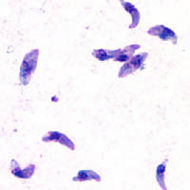 Toxoplasma gondii tachy.jpg
