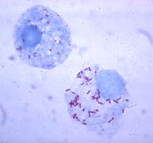 Two round cells with many tiny rod-shaped bacteria inside.
