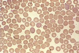 Babiesa spp.jpg